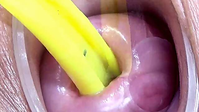 Cervix and Pee Hole Inflation with Injections for Japan Les
